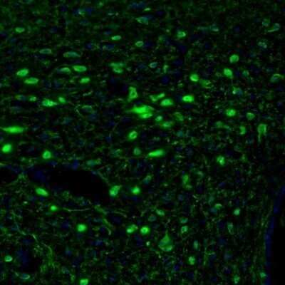 Immunohistochemistry: Calretinin Antibody [NBP1-88221]