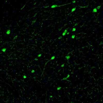 Immunohistochemistry: Calretinin Antibody [NBP1-88221]