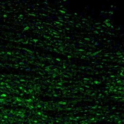 Immunohistochemistry: Calretinin Antibody [NBP1-88221]