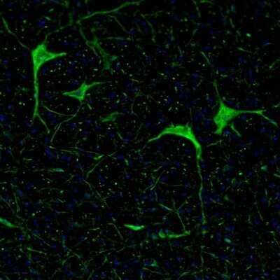 Immunohistochemistry: Calretinin Antibody [NBP1-88221]