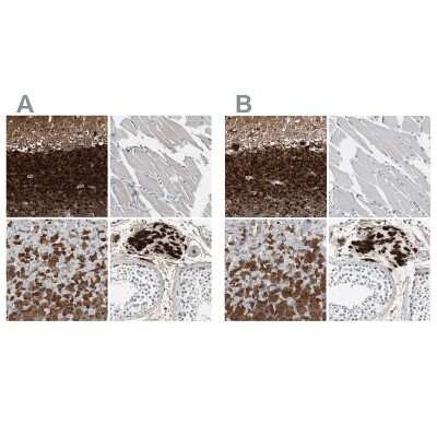 Immunohistochemistry-Paraffin: Calretinin Antibody [NBP1-88221]
