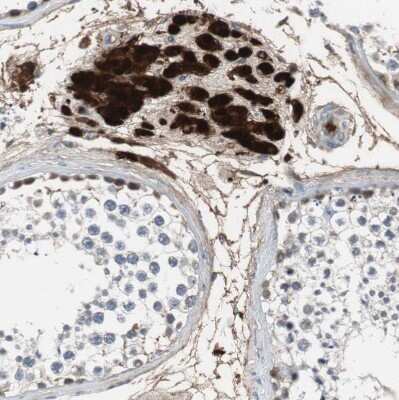 Immunohistochemistry-Paraffin: Calretinin Antibody [NBP1-88221]