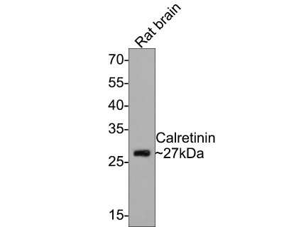 Western Blot: Calretinin Antibody (JM12-93) [NBP2-67206]