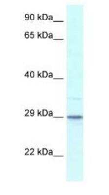 Western Blot: Calsenilin Antibody [NBP1-82380]