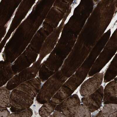 Immunohistochemistry-Paraffin: Calsequestrin 1 Antibody [NBP1-88181]