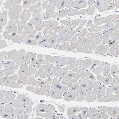 Immunohistochemistry-Paraffin: Calsequestrin 1 Antibody [NBP1-88181]
