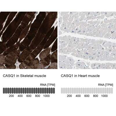 Immunohistochemistry-Paraffin: Calsequestrin 1 Antibody [NBP1-88181]