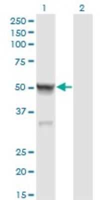 Western Blot: Calsequestrin 2 Antibody (1B6) [H00000845-M01]