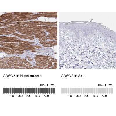 Immunohistochemistry-Paraffin: Calsequestrin 2 Antibody [NBP2-33747]