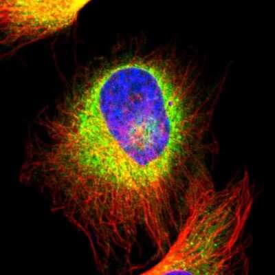 Immunocytochemistry/ Immunofluorescence: Calumenin Antibody [NBP1-90348]