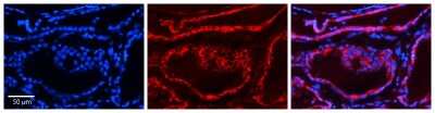 Immunohistochemistry-Paraffin: Calumenin Antibody [NBP2-87120]