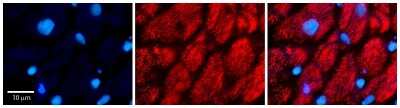 Immunohistochemistry-Paraffin: Calumenin Antibody [NBP2-87120]