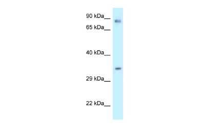 Western Blot: Calumenin Antibody [NBP2-87120]