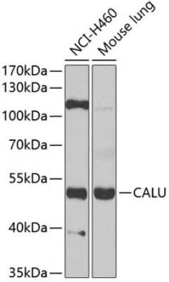 Western Blot: Calumenin AntibodyBSA Free [NBP2-92901]