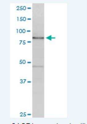 Western Blot: Cancer Antigen 1 Antibody (3H8) [H00285782-M01-100ug]