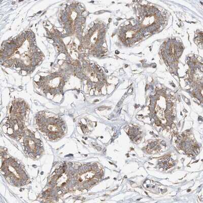 Immunohistochemistry-Paraffin: Cancer Antigen 1 Antibody [NBP1-88736]