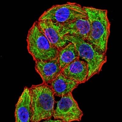 Immunocytochemistry/ Immunofluorescence: Canine Parvovirus Antibody (2G10A3) - BSA Free [NBP2-61721]