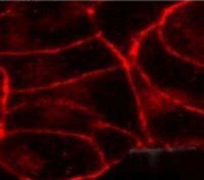 Immunocytochemistry/ Immunofluorescence: Cannabinoid R1/CB1/CNR1 Antibody [NB300-552]