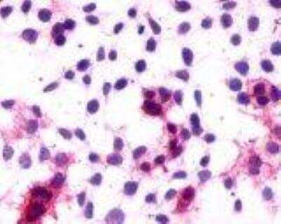 Immunocytochemistry/ Immunofluorescence: Cannabinoid R1/CB1/CNR1 Antibody - BSA Free [NLS32]
