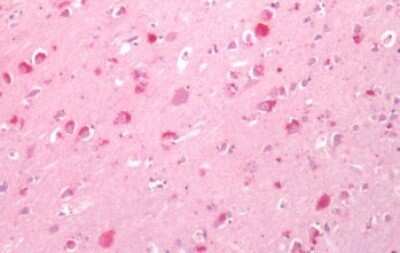 Immunohistochemistry-Paraffin: Cannabinoid R1/CB1/CNR1 Antibody - BSA Free [NLS31]