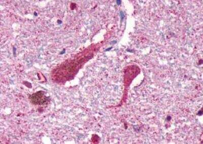 Immunohistochemistry-Paraffin: Cannabinoid R1/CB1/CNR1 Antibody - BSA Free [NLS32]