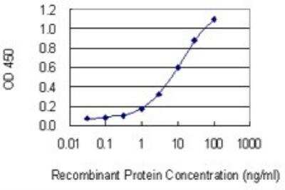 ELISA: Cannabinoid R2/CB2/CNR2 Antibody (3C7) [H00001269-M01]