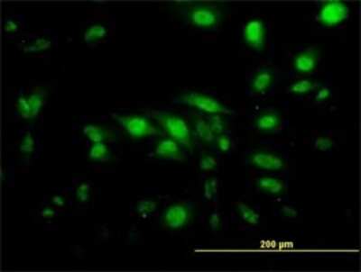 Immunocytochemistry/ Immunofluorescence: CapG Antibody (1F1) [H00000822-M01]