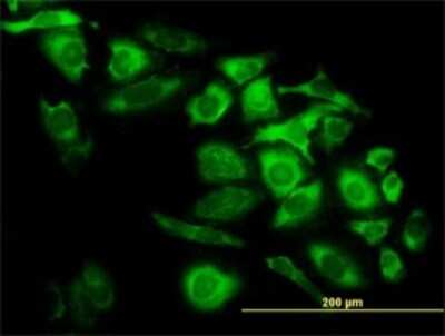 Immunocytochemistry/ Immunofluorescence: CapG Antibody (6D6) [H00000822-M02]