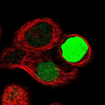 Immunocytochemistry/ Immunofluorescence: CapG Antibody [NBP1-90214]