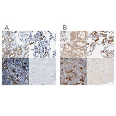 Immunohistochemistry-Paraffin: CapG Antibody [NBP1-90213]