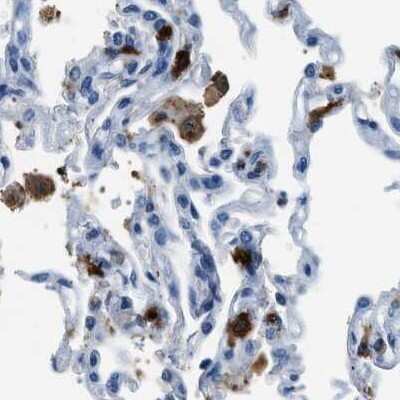 Immunohistochemistry-Paraffin: CapG Antibody [NBP1-90213]