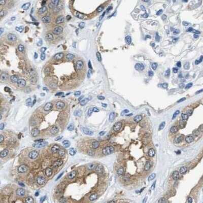 Immunohistochemistry-Paraffin: CapG Antibody [NBP1-90213]