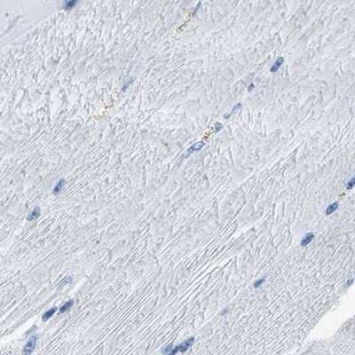 Immunohistochemistry-Paraffin: CapG Antibody [NBP1-90213]