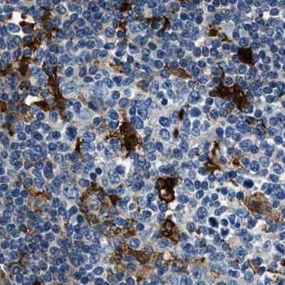 Immunohistochemistry-Paraffin: CapG Antibody [NBP1-90213]