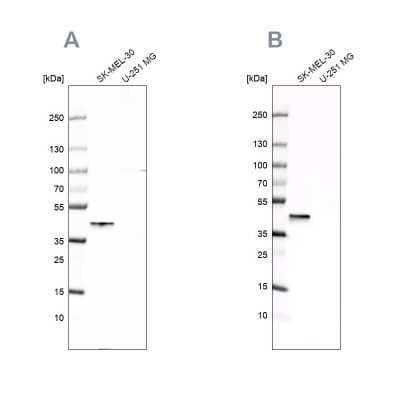 Western Blot: CapG Antibody [NBP1-90213]