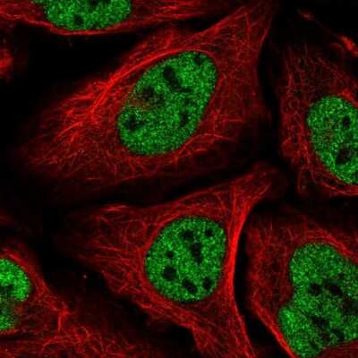 Immunocytochemistry/ Immunofluorescence: Capicua Antibody [NBP2-33420]