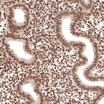 Immunohistochemistry-Paraffin: Capicua Antibody [NBP2-33420]