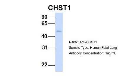 Western Blot: Carbohydrate Sulfotransferase 1/CHST1/KS6ST Antibody [NBP1-62370]