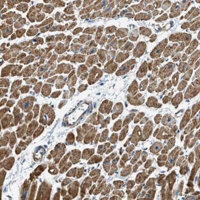 Immunohistochemistry-Paraffin: Carbohydrate Sulfotransferase 15/CHST15 Antibody [NBP1-88367]