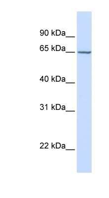 Western Blot: Carbohydrate Sulfotransferase 15/CHST15 Antibody [NBP1-59012]