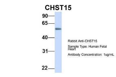Western Blot: Carbohydrate Sulfotransferase 15/CHST15 Antibody [NBP1-59012]