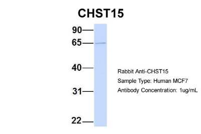 Western Blot: Carbohydrate Sulfotransferase 15/CHST15 Antibody [NBP1-59012]