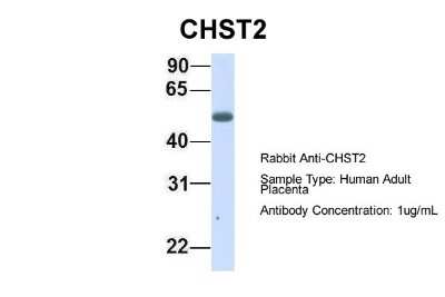Western Blot: Carbohydrate Sulfotransferase 2/CHST2 Antibody [NBP1-59944]