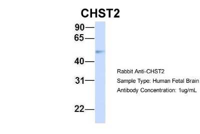 Western Blot: Carbohydrate Sulfotransferase 2/CHST2 Antibody [NBP1-59944]