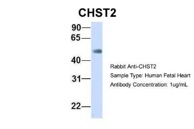 Western Blot: Carbohydrate Sulfotransferase 2/CHST2 Antibody [NBP1-59944]