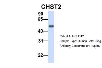Western Blot: Carbohydrate Sulfotransferase 2/CHST2 Antibody [NBP1-59944]
