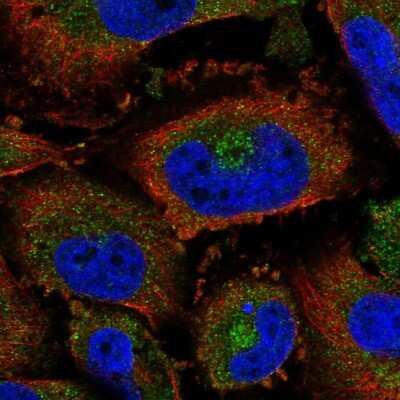 Immunocytochemistry/ Immunofluorescence: Carbohydrate Sulfotransferase 3/CHST3 Antibody [NBP2-57128]
