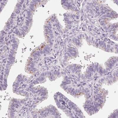 Immunohistochemistry-Paraffin: Carbohydrate Sulfotransferase 4/CHST4 Antibody [NBP1-91748]