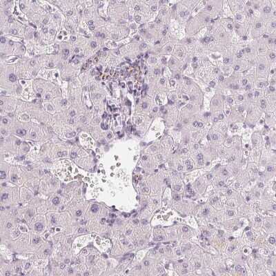 Immunohistochemistry-Paraffin: Carbohydrate Sulfotransferase 4/CHST4 Antibody [NBP1-91748]