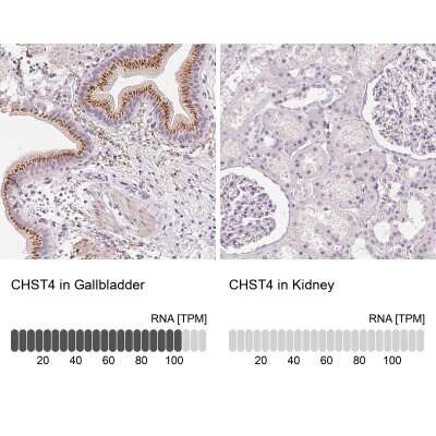 Immunohistochemistry-Paraffin: Carbohydrate Sulfotransferase 4/CHST4 Antibody [NBP1-91748]